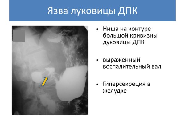 Ссылка на магазин кракен